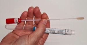 HPV self-test approved by the U.S. Health Department